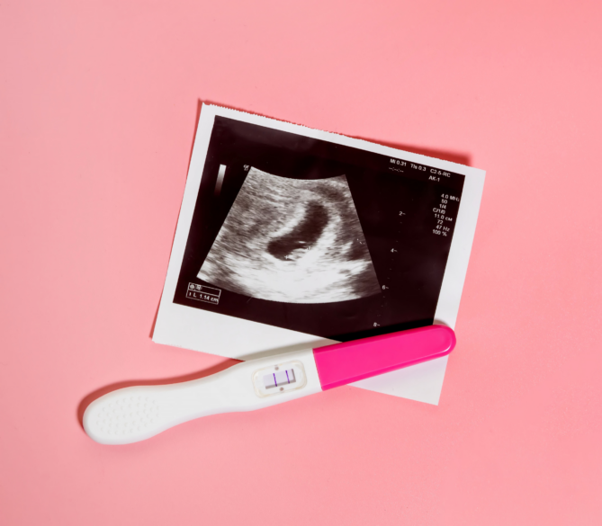 How Many Donor Egg Cycles to Expect Before Pregnancy is represented by an ultrasound image and pregnancy test placed on a light pink background.